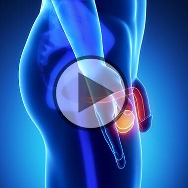 Gutartige Prostatavergrößerung - Video