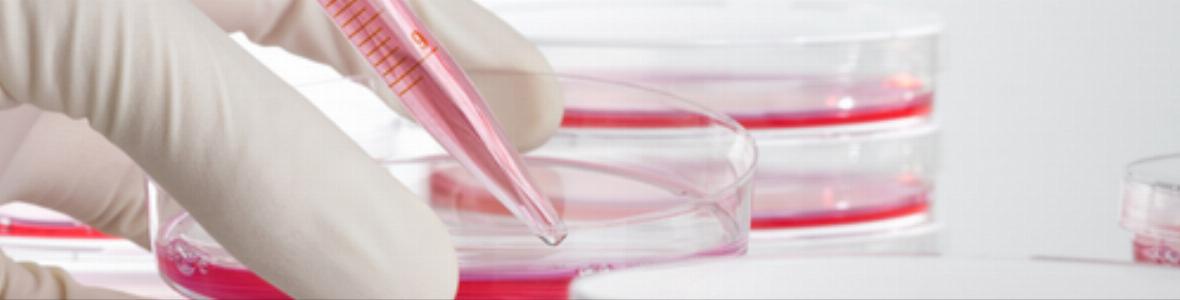 Alzheimer: Bluttest spürt frühzeitig Risiko auf