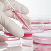 Alzheimer: Bluttest spürt frühzeitig Risiko auf
