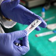HIV-Selbsttests für zuhause in Österreich bewilligt