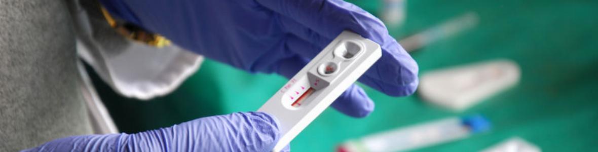 HIV-Selbsttests für zuhause in Österreich bewilligt