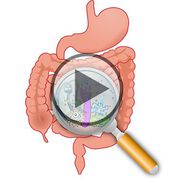 Liegt der Schlüssel zur Gesundheit im Darm? - Video