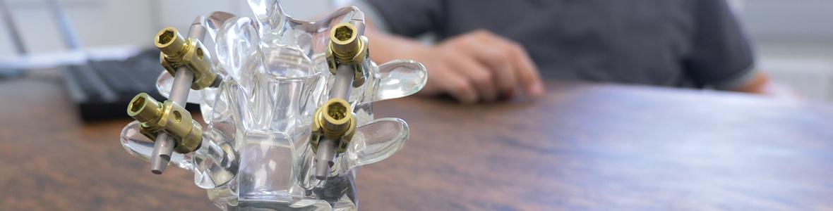 Minimal invasive Spondylodese bei Gleitwirbel mit Spinalkanalstenose - Video