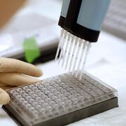 Prostatakrebs: Forschung im Aufholprozess