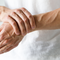 Fakten zu Psoriasis Arthritis - Video