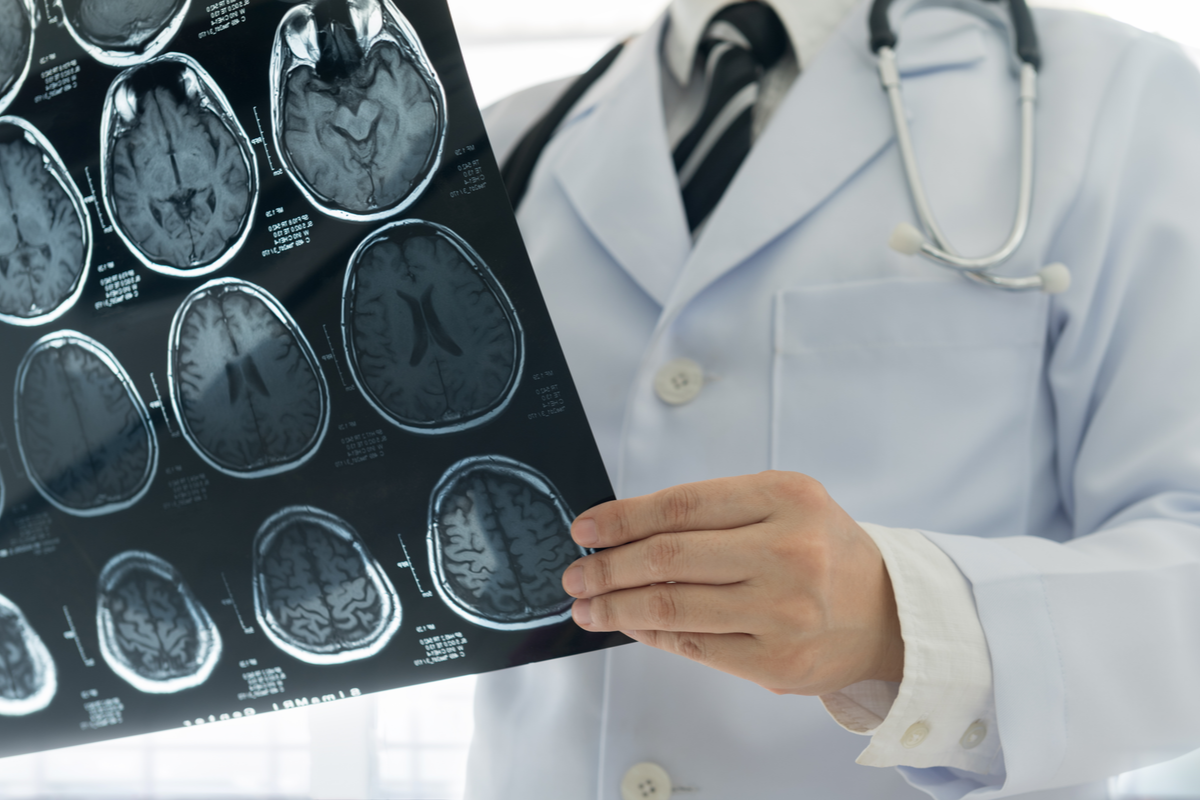 7 Tesla immer wichtiger bei Therapie-Monitoring