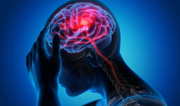 Neuer Ansatz in der Migräneprävention: Studie zeigt Wirksamkeit