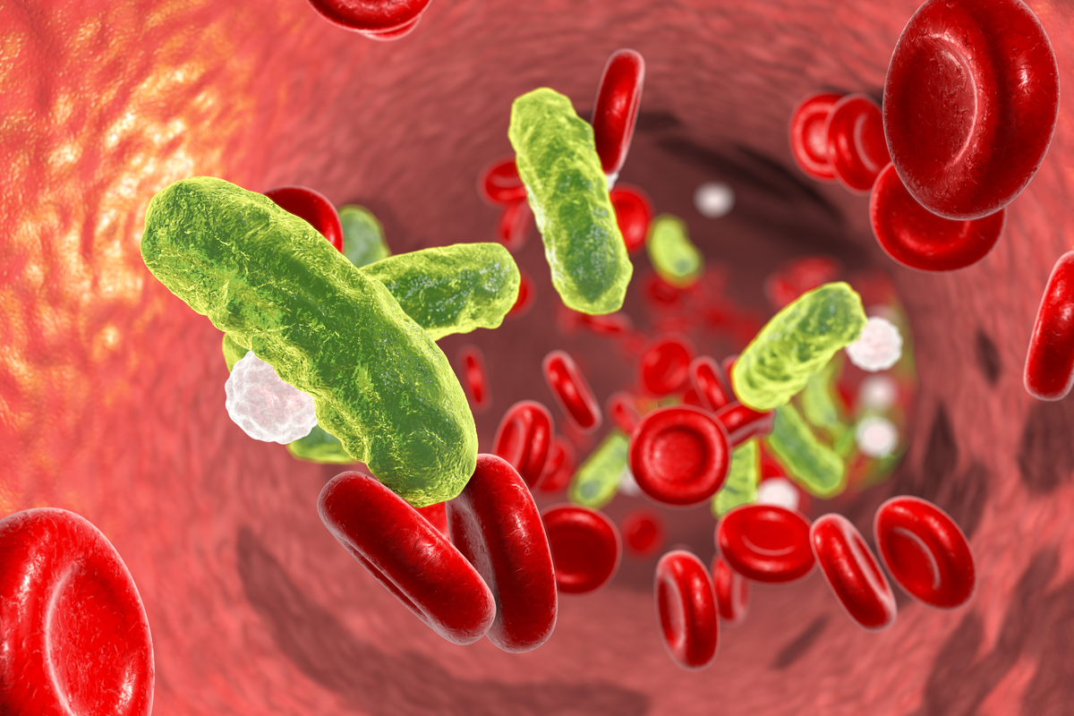 Sepsis: Früherkennung rettet Leben