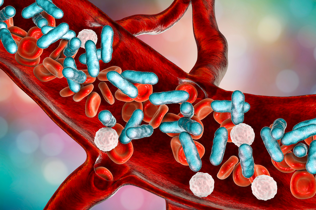Sepsis: Früherkennung ist entscheidend