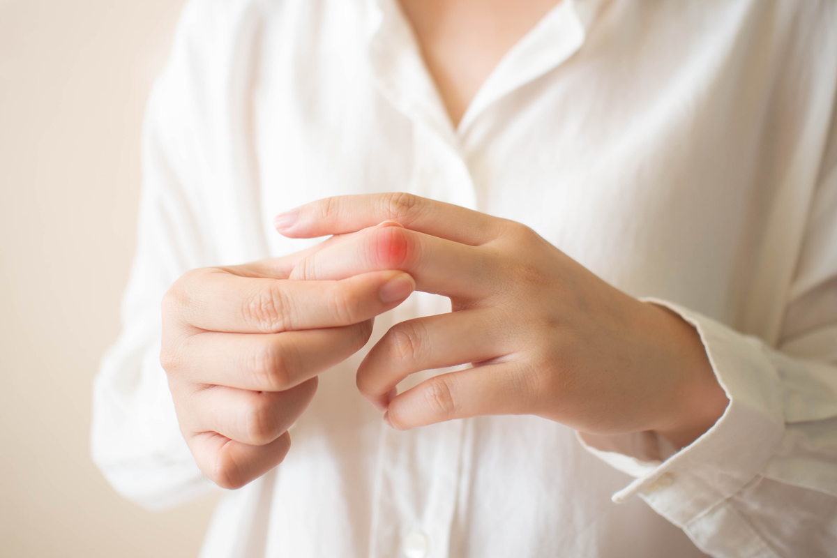 Psoriasis-Arthritis: Schuppenflechte mit Gelenkbeteiligung (Video)