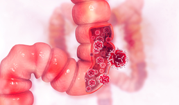 Unerwartete Rolle des Proteins mTORC2 bei Darmkrebs