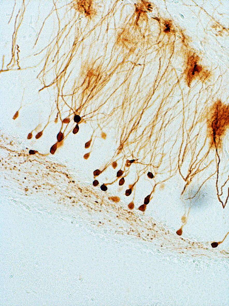 Gentherapie bei Epilepsie