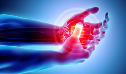Rheumatoide Arthritis: Arginin als Ansatzpunkt für mögliche Therapien