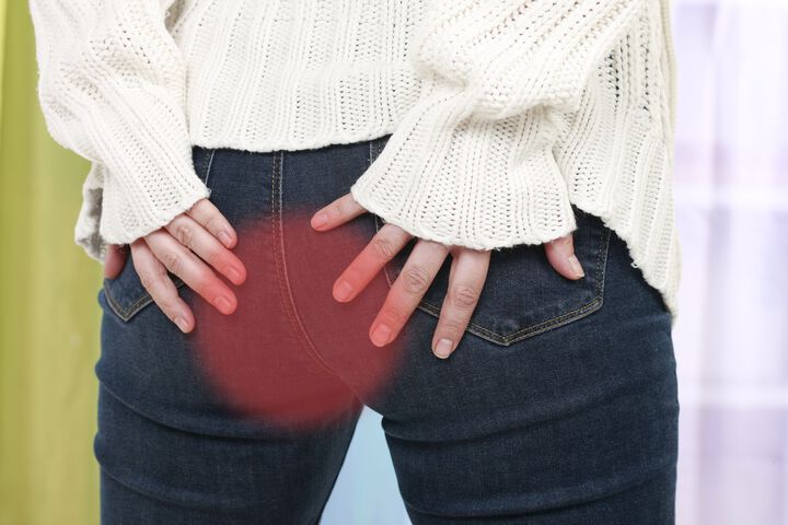 Hämorrhoiden: Schätzungen zufolge werden neun von zehn Patienten unnötig operiert