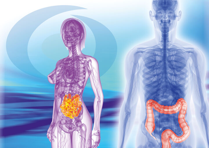 Haben CED-PatientInnen ein höheres Risiko für einen schwereren Krankheitsverlauf bei einer Coronavirus SARS-CoV-2 Erkrankung?