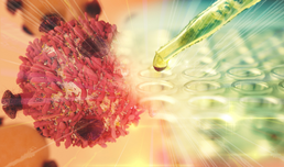 ALCL-Lymphom: Kombinationstherapie zur Vermeidung von Behandlungsresistenzen ratsam