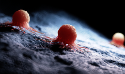 Rippenfellkrebs: Biomarker für Aggressivität und mögliche neue Therapiestrategie gefunden