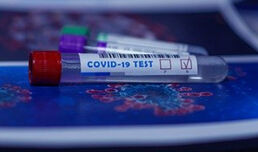 Coronavirus: Doppelte Vorsicht rund um Massentests geboten