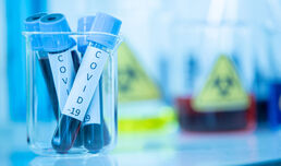 Spezifische Immunantwort in der Frühphase einer SARS CoV-2-Infektion identifiziert