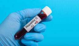 Leberkrebs nach Hepatitis C: Neues Tool zur Risikoeinschätzung entwickelt