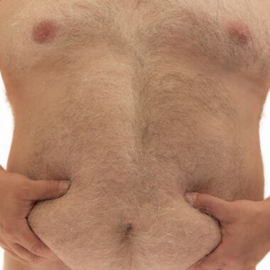 Österreichweit neue Therapie für Adipositas