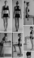 Subcutaneous fat patterning - Subcutane Fettmessung