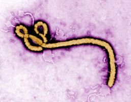 Ebola bald heilbar? Optimierte Therapie gegen Ebola in Sicht!