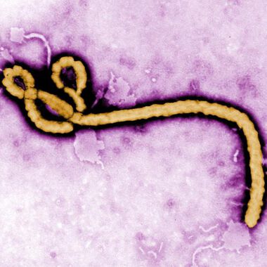 Ebola bald heilbar? Optimierte Therapie gegen Ebola in Sicht!