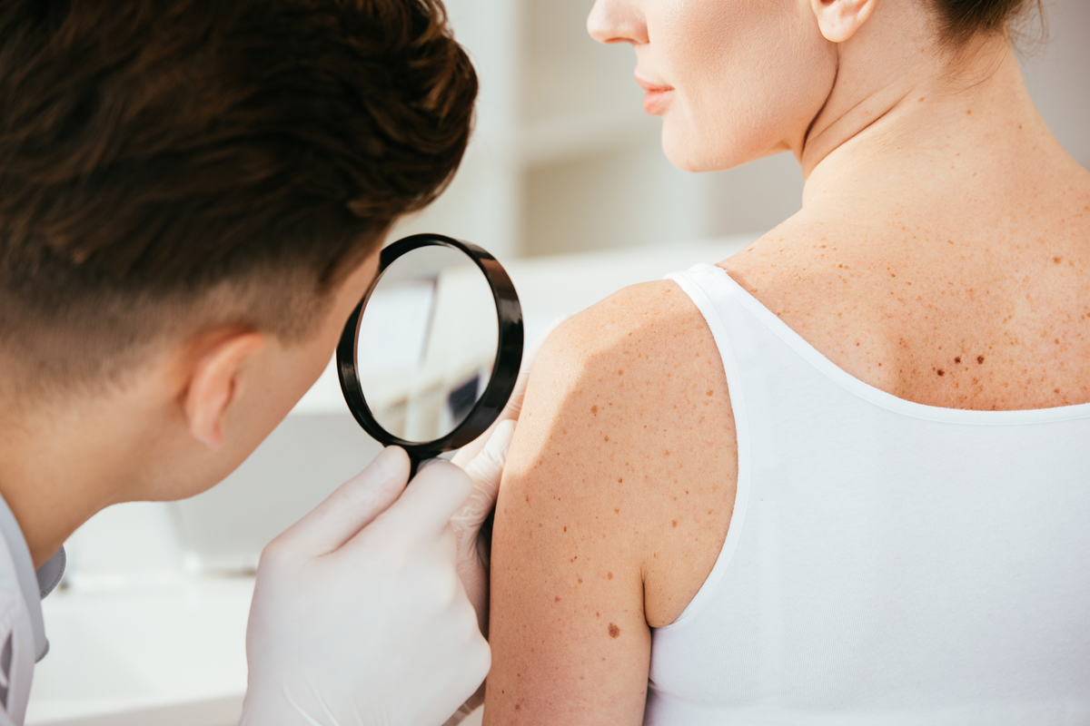 4 Tipps für Patienten nach der Melanomtherapie