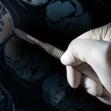 Grazer Chirurgen geben Hoffnung bei Lebermetastasen