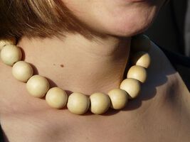 Schilddrüsenkrebs: Gute Prognose, trotzdem belastend