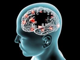 Übertragbarkeit von Alzheimer: keine Krankheitssymptome