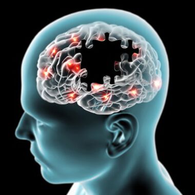 Übertragbarkeit von Alzheimer: keine Krankheitssymptome