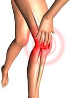 Erfolge bei der Behandlung von rheumatoider Arthritis