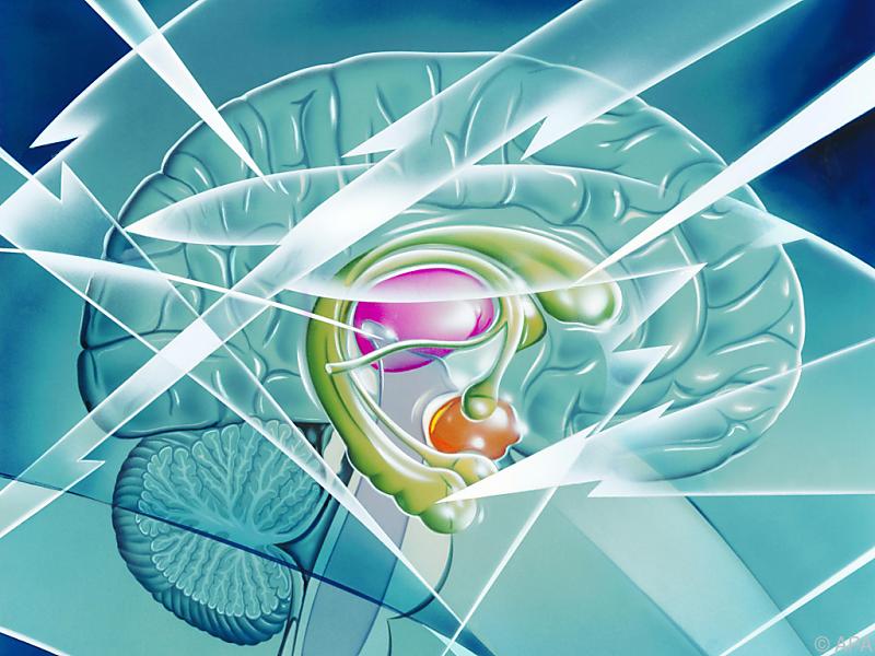 Auch scheinbar gesundes Gehirngewebe spielt bei Epilepsie eine Rolle