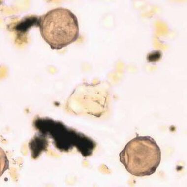 Allergiker reagieren bei nicht-allergenen Pollen-Substanzen verstärkt