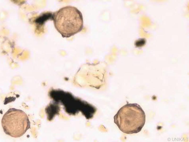 Allergiker reagieren bei nicht-allergenen Pollen-Substanzen verstärkt