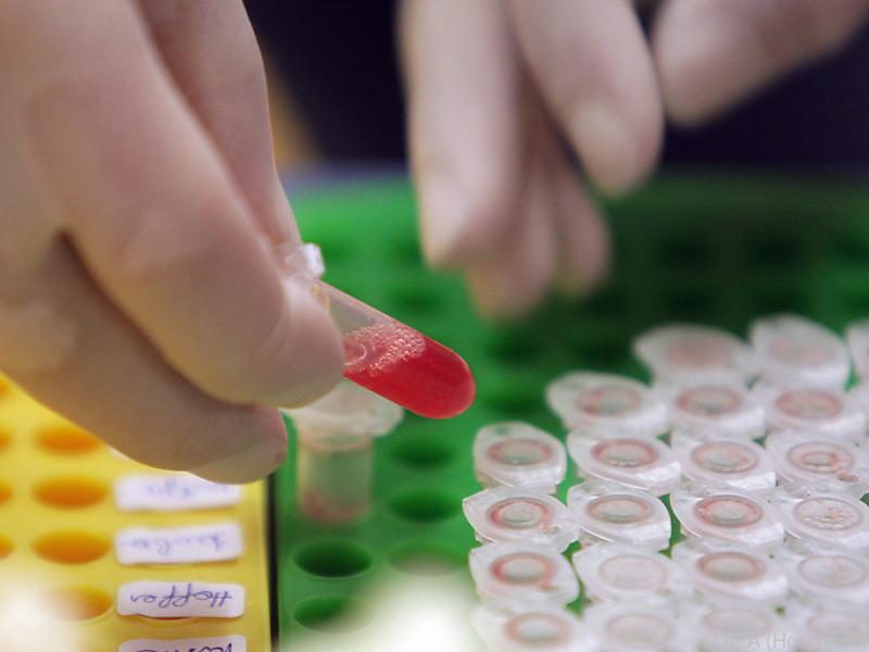 Aminosäure als Biomarker für die Herzinfarktgefahr