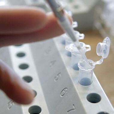 Neue Immuntherapie mit Nanopartikeln erfolgreich gegen Krebs