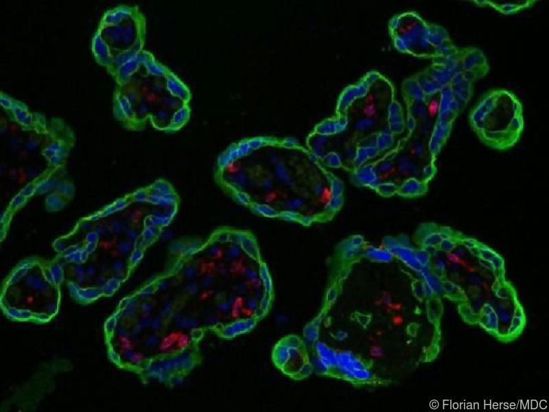 Bei Präeklampsie ist wichtiges Immunprotein der Plazenta verringert