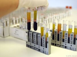 Patienten mit Rheuma leiden öfter an Infektionen
