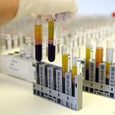 Patienten mit Rheuma leiden öfter an Infektionen