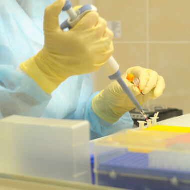 Forscher können nun genauer Rückfallwahrscheinlichkeit bei Prostatakrebs-Patienten bestimmen