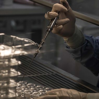 System entwickelt, das die Analyse der nicht-alkoholischen Fettleber ohne Biopsie ermöglicht