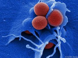 Neuer Wirkstoff gegen HIV und MRSA gefunden