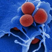 Neuer Wirkstoff gegen HIV und MRSA gefunden