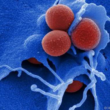 Neuer Wirkstoff gegen HIV und MRSA gefunden
