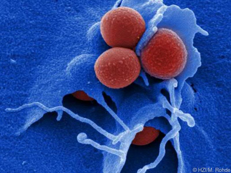 Neuer Wirkstoff gegen HIV und MRSA gefunden