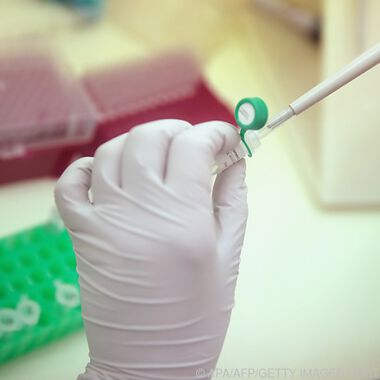 Virusinfektionen unter Verdacht: Können sie Autoimmunerkrankungen auslösen?