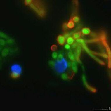 Forscher identifizieren Immunbremse gegen Pilzinfektionen